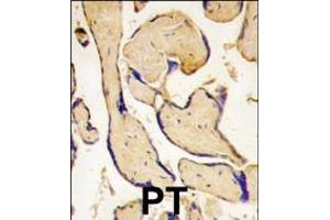 Formalin-fixed and paraffin-embedded human placenta tissue reacted with EphA3 antibody (C-term ), which was peroxidase-conjugated to the secondary antibody, followed by DAB staining.