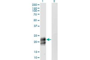 Western Blot analysis of TNFRSF17 expression in transfected 293T cell line by TNFRSF17 monoclonal antibody (M06), clone 3H6. (BCMA Antikörper  (AA 1-184))