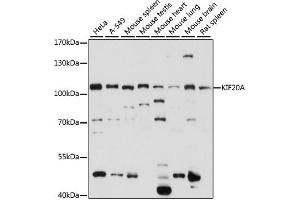 Western blot analysis of extracts of various cell lines, using KIF20A antibody (ABIN7268125) at 1:1000 dilution. (KIF20A Antikörper  (AA 591-890))