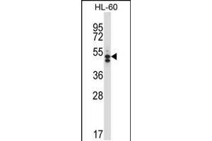 Western blot analysis in HL-60 cell line lysates (35ug/lane). (HDAC7 Antikörper  (C-Term))