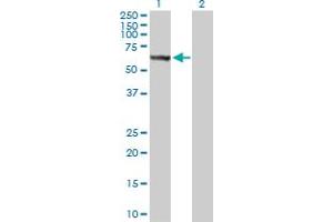 Western Blot analysis of STK33 expression in transfected 293T cell line by STK33 MaxPab polyclonal antibody. (STK33 Antikörper  (AA 1-514))