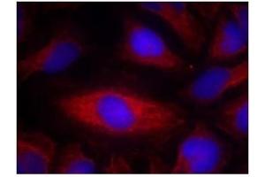 Image no. 2 for anti-Phospholipase C gamma 2 (PLCG2) (Tyr1217) antibody (ABIN319402)