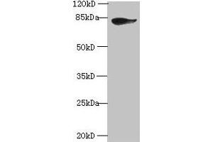 Western blot All lanes: JUP antibody at 2 μg/mL + A431 whole cell lysate Secondary Goat polyclonal to rabbit IgG at 1/10000 dilution Predicted band size: 82 kDa Observed band size: 82 kDa (JUP Antikörper  (AA 1-131))