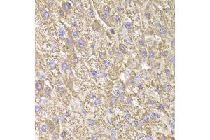 Immunohistochemistry of paraffin-embedded human liver injury using CIAPIN1 Antibody (ABIN1980352) at dilution of 1:100 (40x lens). (CIAPIN1 Antikörper)