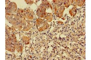 Immunohistochemistry (IHC) image for anti-Ribosomal Protein S5 (RPS5) (AA 1-204) antibody (ABIN7142563)