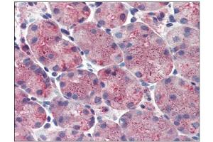 Stomach: Formalin-Fixed, Paraffin-Embedded (FFPE) (ERP44 Antikörper  (Internal Region))