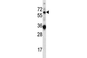 GATAD2B antibody western blot analysis in mouse heart tissue lysate (GATAD2B Antikörper  (AA 1-30))