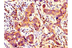 Immunohistochemistry (IHC) image for anti-BCL2-Like 1 (BCL2L1) (AA 1-209) antibody (ABIN7145294)