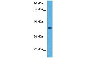 Host:  Rabbit  Target Name:  SLC25A32  Sample Tissue:  Human Jurkat Whole Cell  Antibody Dilution:  1ug/ml (SLC25A32 Antikörper  (N-Term))