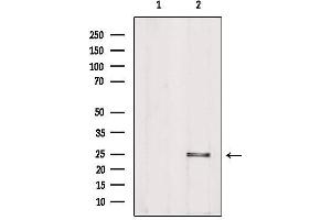Western blot analysis of extracts from Hela, using PIGF Antibody. (PIGF Antikörper  (Internal Region))