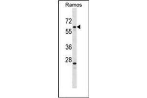 Western blot analysis of PLRG1 Antibody (N-term) in Ramos cell line lysates (35ug/lane). (PLRG1 Antikörper  (N-Term))