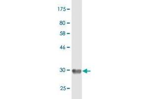 Western Blot detection against Immunogen (33. (EMR4P Antikörper  (AA 21-93))
