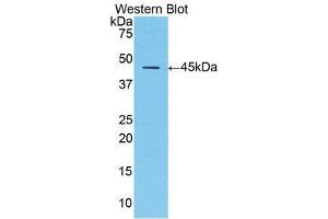 Western Blotting (WB) image for anti-serpin Peptidase Inhibitor, Clade A (Alpha-1 Antiproteinase, Antitrypsin), Member 1 (SERPINA1) (AA 25-413) antibody (ABIN1077772) (SERPINA1 Antikörper  (AA 25-413))
