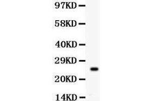 Anti- PSA Picoband antibody, Western blotting All lanes: Anti PSA  at 0. (Prostate Specific Antigen Antikörper  (AA 25-261))