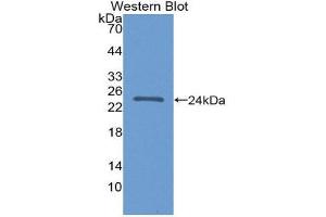 Western Blotting (WB) image for anti-Fibroblast Growth Factor 21 (FGF21) (AA 25-208) antibody (ABIN1867955)