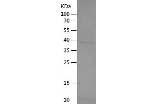 Thrombopoietin Protein (THPO) (AA 22-195) (His-IF2DI Tag)