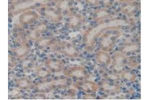 IHC-P analysis of Rat Kidney Tissue, with DAB staining. (GATA4 Antikörper  (AA 228-440))