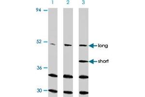 Western blot analysis of CASP2 in Ramos cells with CASP2 polyclonal antibody at (A) 0. (Caspase 2 Antikörper  (N-Term))