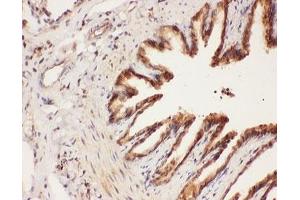 IHC-P: ALOX15 antibody testing of rat lung tissue (ALOX15 Antikörper  (AA 2-337))