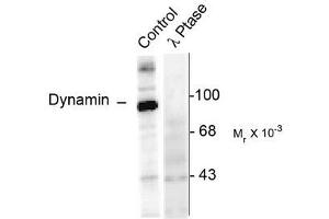 Image no. 1 for anti-Dynamin 1 (DNM1) (pSer774) antibody (ABIN372616) (Dynamin 1 Antikörper  (pSer774))