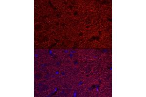Immunofluorescence analysis of rat brain cells using M Rabbit pAb (ABIN1680751, ABIN3015149, ABIN3015150 and ABIN6213853) at dilution of 1:25 (40x lens). (MAP2 Antikörper  (AA 260-559))