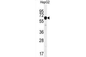 Western Blotting (WB) image for anti-Insulin-Like Growth Factor 2 mRNA Binding Protein 2 (IGF2BP2) antibody (ABIN2995531) (IGF2BP2 Antikörper)