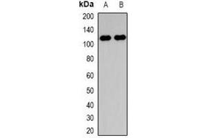Western blot analysis of Collagen 28 alpha 1 expression in HepG2 (A), NIH3T3 (B) whole cell lysates.