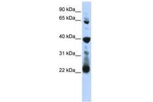 Image no. 1 for anti-RNA Pseudouridylate Synthase Domain Containing 3 (RPUSD3) (AA 251-300) antibody (ABIN6743049) (RPUSD3 Antikörper  (AA 251-300))