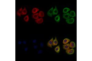 ABIN6262448 and ABIN6272326 staining Hela cells by IF/ICC. (IFIT1 Antikörper  (Internal Region))