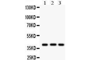 Western Blotting (WB) image for anti-Major Histocompatibility Complex, Class I, A (HLA-A) (AA 82-106), (N-Term) antibody (ABIN3043842)