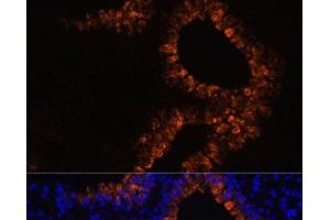 Immunofluorescence analysis of Mouse lung cells using SCGB1A1 Polyclonal Antibody at dilution of 1:100. (SCGB1A1 Antikörper)