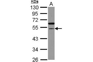 Western Blotting (WB) image for anti-Cell Division Cycle Associated 7-Like (CDCA7L) (AA 184-397) antibody (ABIN1497406) (CDCA7L Antikörper  (AA 184-397))