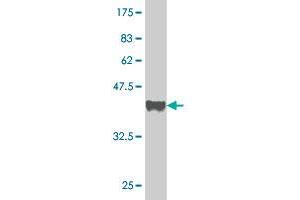 Western Blot detection against Immunogen (37 KDa) . (PCNA Antikörper  (AA 78-177))