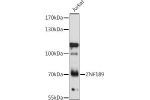 Western blot analysis of extracts of Jurkat cells, using ZNF189 antibody (ABIN7271463) at 1:1000 dilution. (ZNF189 Antikörper  (AA 1-150))