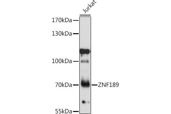 ZNF189 anticorps  (AA 1-150)
