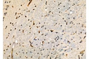 ABIN6264434 and ABIN6277935 at 1/100 staining Mouse brain tissue by IHC-P. (PRMT7 Antikörper  (Internal Region))