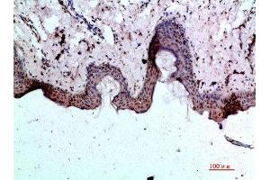 Immunohistochemical analysis of paraffin-embedded human-skin, antibody was diluted at 1:200 (BMP1 Antikörper  (AA 131-180))