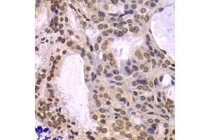 Immunohistochemistry (Paraffin-embedded Sections) (IHC (p)) image for anti-Polymerase (DNA-Directed), delta 3, Accessory Subunit (POLD3) (AA 197-466) antibody (ABIN6145881)
