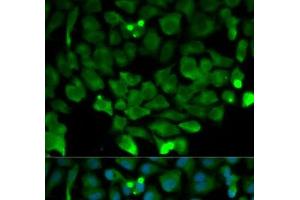 Immunofluorescence analysis of HeLa cells using CUL3 Polyclonal Antibody (Cullin 3 Antikörper)