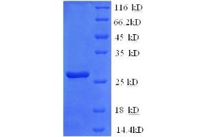 SDS-PAGE (SDS) image for Interleukin 2 Receptor, beta (IL2RB) (AA 24-240), (Extracellular) protein (His tag) (ABIN5713558) (IL2 Receptor beta Protein (AA 24-240, Extracellular) (His tag))