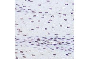 Immunohistochemistry of paraffin-embedded human esophageal using POLR2A Rabbit pAb (ABIN6130298, ABIN6145914, ABIN6145915 and ABIN6215095) at dilution of 1:50 (40x lens). (POLR2A/RPB1 Antikörper  (AA 1-260))