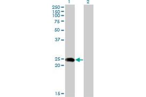 Western Blot analysis of BIN3 expression in transfected 293T cell line by BIN3 monoclonal antibody (M02A), clone 1H8. (BIN3 Antikörper  (AA 1-199))