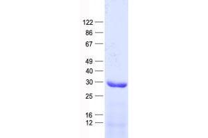 Western Blotting (WB) image for Nuclear Receptor Subfamily 1, Group I, Member 3 (NR1I3) protein (His tag) (ABIN2712335)