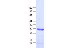 Validation with Western Blot (NR1I3 Protein (His tag))