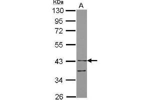 WB Image Sample (30 ug of whole cell lysate) A: THP-1 10% SDS PAGE antibody diluted at 1:10000