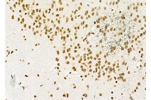 ABIN6262198 and ABIN6279481 at 1/100 staining Rat brain tissue by IHC-P. (HEATR1 Antikörper  (Internal Region))