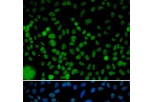 Immunofluorescence analysis of HeLa cells using IRF2 Polyclonal Antibody (IRF2 Antikörper)