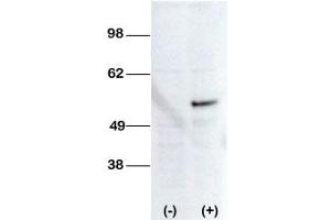 Image no. 2 for anti-serine/threonine Kinase 38 Like (STK38L) (C-Term) antibody (ABIN360006) (STK38L Antikörper  (C-Term))