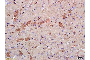 Formalin-fixed and paraffin embedded mouse heart labeled with Rabbit Anti phospho-LATS2 (Ser83) Polyclonal Antibody, Unconjugated (ABIN753568) at 1:200 followed by conjugation to the secondary antibody and DAB staining (LATS2 Antikörper  (pSer83))