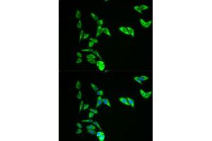 Immunofluorescence analysis of A549 cell using AK1 antibody. (Adenylate Kinase 1 Antikörper  (AA 1-194))
